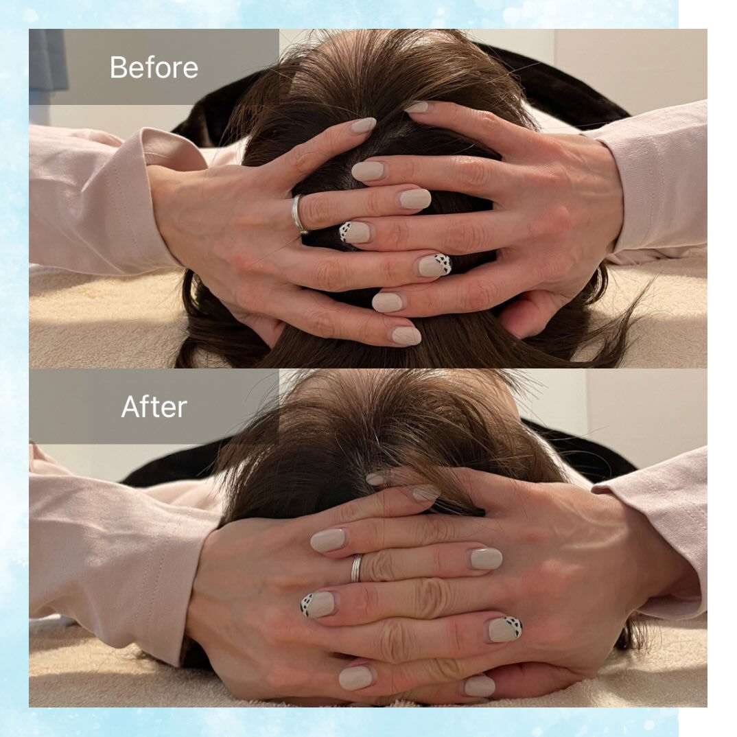慢性的な頭痛や頭の重だるさにお悩みで、